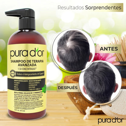 Shampoo Terapia avanzada